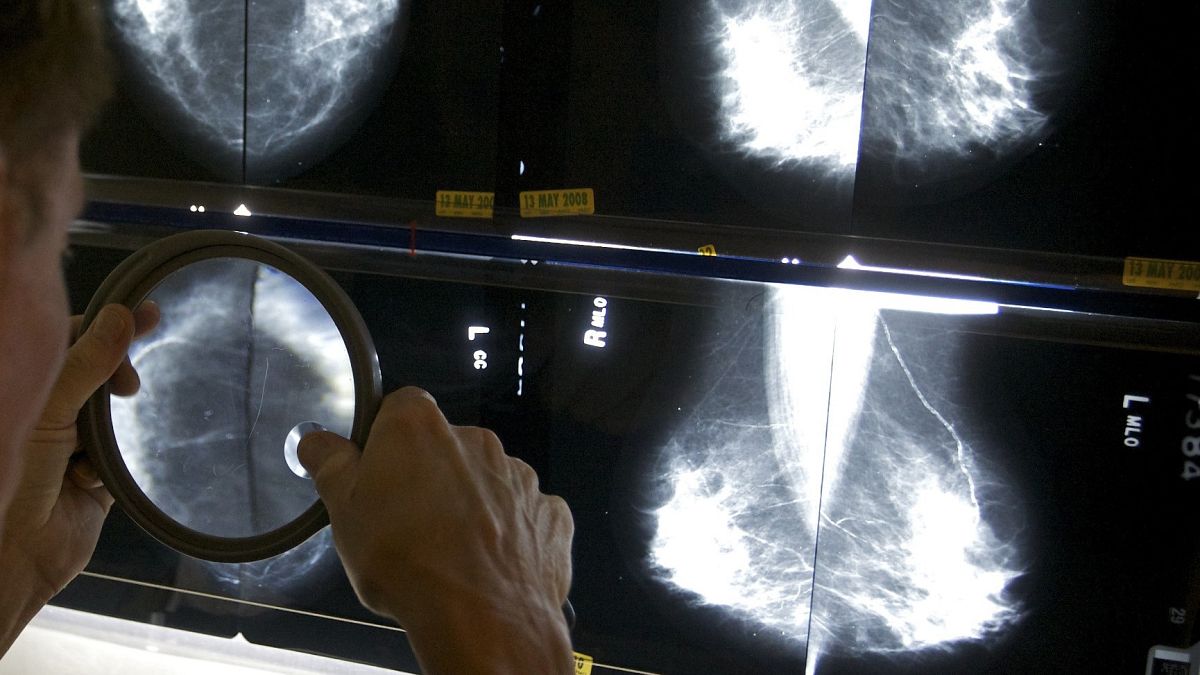 Mammográfiai vizsgálat Los Angelesben