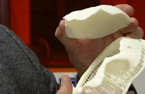 Cráneo impreso 3D
