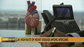 More research needed into heart health of African-Australians