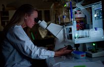 Sophia Schedin Weiss kutató és docens neuronokat vizsgál mikroszkópban. Fotók az Alzheimer-kutatásról a Huddinge Neurobiológiai, Gondozástudományi és Társadalmi Tanszéken 2015