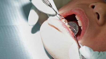 Dental amalgam - elemental mercury bound with metals such as silver, tin, copper, and zinc - is commonly used to fill teeth. 