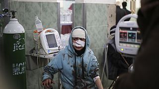 A Palestinian wounded in the Israeli bombardment sits in a hospital In Rafah, Gaza Strip, Saturday, Feb. 10, 2024.
