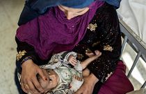 عکس آرشیوی از زن افغان به همراه کودکش در بیمارستان