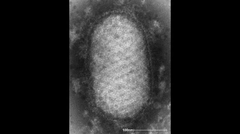 آبله آلاسکایی از دسته ویروس‌های موسوم به «پاکس‌ویریده» است