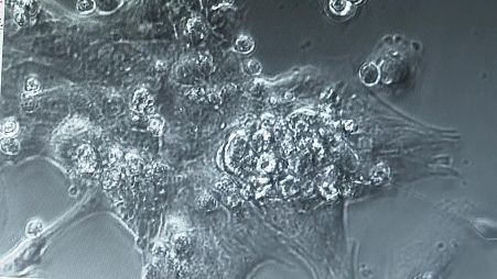 Microscopic view of a healthy heart cells growing in a dish in lab at the University of East London