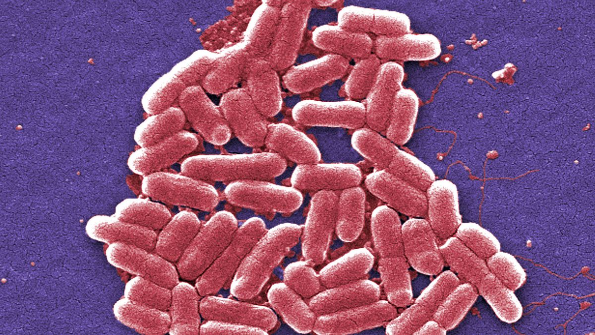 Esta imagen de micrografía electrónica de barrido coloreada de 2006 muestra la cepa O157:H7 de la bacteria E. coli.