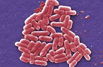 Esta imagen de micrografía electrónica de barrido coloreada de 2006 muestra la cepa O157:H7 de la bacteria E. coli.