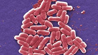 This 2006 colorized scanning electron micrograph image shows the O157:H7 strain of the E. coli bacteria.