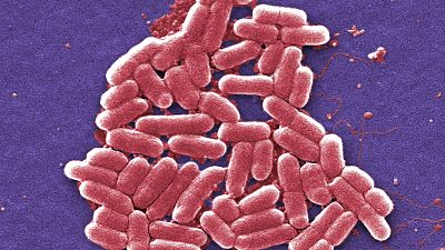 Cette image de micrographie électronique à balayage colorisée de 2006 montre la souche O157:H7 de la bactérie E. coli.
