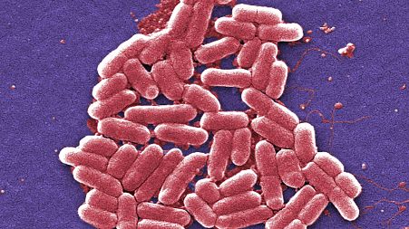 This 2006 colorized scanning electron micrograph image shows the O157:H7 strain of the E. coli bacteria.
