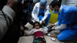 جرحى فلسطينيون أصيبوا في القصف الإسرائيلي على قطاع غزة تم نقلهم إلى مستشفى الأقصى في دير البلح