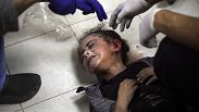 Gazze'de tedavisi yapılan yaralı bir çocuk