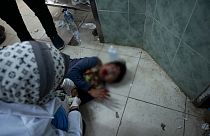 İsrail güçlerinin, Gazze'de insani yardım almak için bekleyen sivillere yönelik saldırısında en az 77 kişi öldü, 280'den fazla kişi de yaralandı