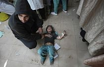 Palestinianos feridos nos bombardeamentos israelitas na Faixa de Gaza são levados para o hospital Al Aqsa em Deir al Balah, Faixa de Gaza, sexta-feira, 8 de março de 2024. 