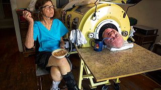 Paul Alexander demir akciğerde en uzun süre yaşayan kişi olarak Guinness Rekorlar kitabına girdi