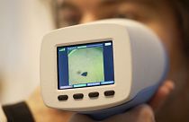 Une nouvelle technologie pour détecter les cancers de la peau en 30 secondes
