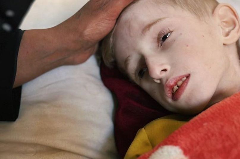 Fadi, Gazze'deki Kemal Advan Hastanesi'nde tedavi görüyor.