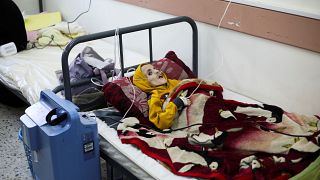 طفل فلسطيني يعاني من الهزال الشديد بسبب المجاعة