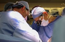 Surgeons carry out an experimental pig kidney transplant.