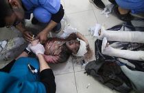 فلسطينيون أصيبوا في القصف الإسرائيلي يتلقون العلاج في مستشفى في رفح، قطاع غزة. الأحد، 24 مارس/آذار 2024