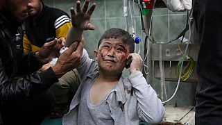 Palestinians wounded in the Israeli bombardment are brought to a hospital in Rafah, Gaza Strip. Sunday, March 24, 2024.