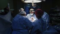 أطباء يجرون عملية جراحية في مستشفى شهداء الأقصى في دير البلح. 2024/03/17