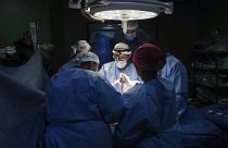 أطباء يجرون عملية جراحية في مستشفى شهداء الأقصى في دير البلح. 2024/03/17