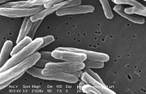 This 2006 electron microscope image provided by the Centers for Disease Control and Prevention shows Mycobacterium tuberculosis bacteria, which causes the disease tuberculosis