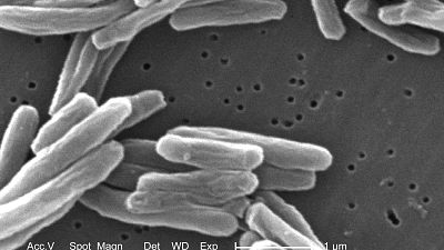 This 2006 electron microscope image provided by the Centers for Disease Control and Prevention shows Mycobacterium tuberculosis bacteria, which causes the disease tuberculosis