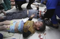 أطفال في مستشفى في رفح إثر غارة إسرائيلية