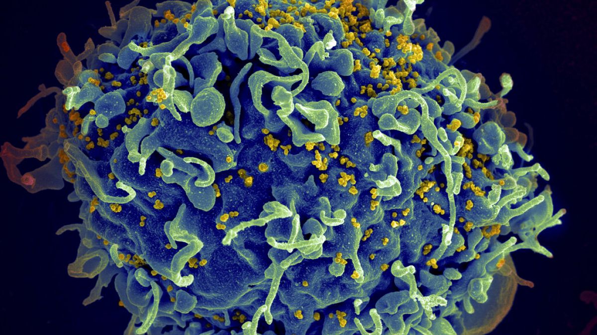 Esta imagen de microscopio electrónico facilitada por los Institutos Nacionales de Salud de EE.UU. muestra una célula T humana, en azul, atacada por el VIH, en amarillo, el virus que causa la gripe aviar.