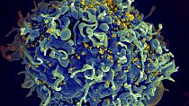 This electron microscope image made available by the U.S. National Institutes of Health shows a human T cell, in blue, under attack by HIV, in yellow, the virus that causes AI