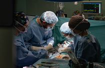 El Dr. Daniel Pereda (izquierda), durante la cirugía cardíaca robótica en el Hospital Clinic de Barcelona el 8 de abril de 2024.
