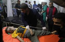 Тяжелораненого мальчика привезли в Кувейтскую больницу в Рафахе, 19 апреля 2024 года.