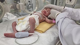 Annesi İsrail bombardımanında ölen ve kendisi sezeryanla alınarak yaşatılmaya çalışılan Gazzeli Sabrin bebek