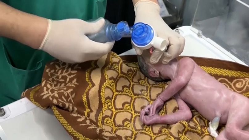 Gazzeli 30 haftalık hamile bir kadının İsrail bombardımanında ölmesinin ardından karnındaki bebeği sezaryenle alındı. Kız bebeğe annesinin adı olan Sabrin ismi verildi
