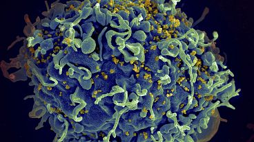 Esta imagem de microscópio electrónico mostra uma célula T humana, a azul, sob ataque do VIH, a amarelo, o vírus causador da SIDA.