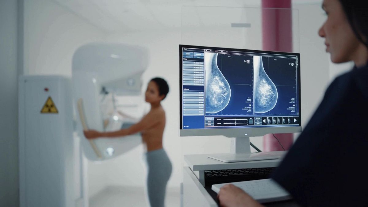 Why US experts are now recommending breast cancer screenings for women in their 40s thumbnail