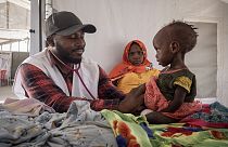 A csádi Metche-táborban az MSF (Orvosok HAtárok Nélkül) szervezet orvosa vizsgál egy szudáni kisgyereket 2024. április 6-án 
