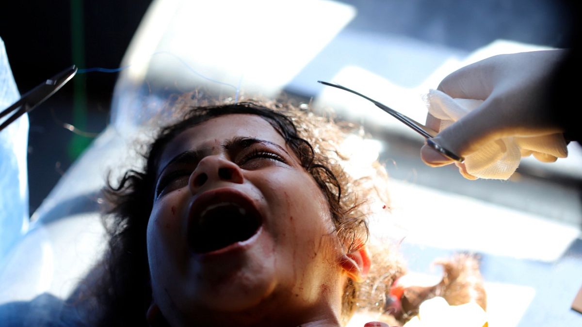 طفلة فلسطينية تبكي من الوجع بعد إصابتها بقصف إسرائيلي 