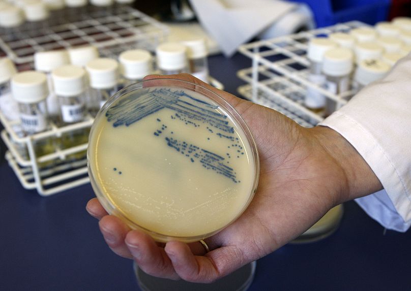 Esta fotografía de 2009 muestra una placa de Petri con cultivos de Staphylococcus aureus resistente a la meticilina en un hospital de Inglaterra.
