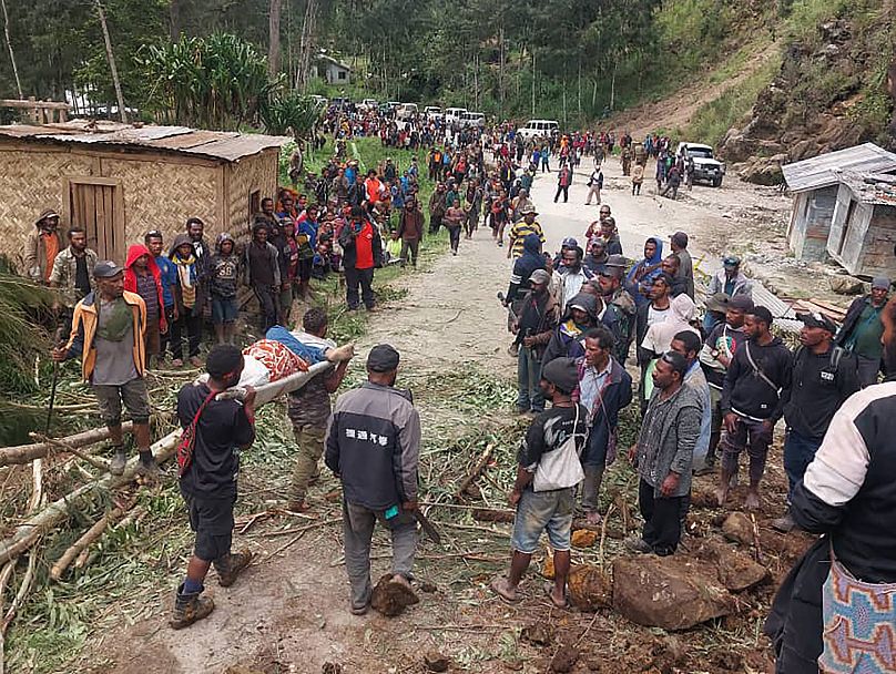 Un blessé est transporté sur une civière pour obtenir une assistance médicale après un glissement de terrain dans le village de Yambali