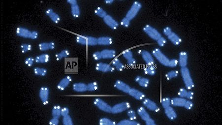 تظهر هذه الصورة المجهرية الكروموسومات البشرية البالغ عددها 46، باللون الأزرق، مع ظهور التيلوميرات على شكل نقاط بيضاء.