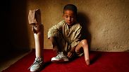 محمد مهدی که پای خود را بر اثر انفجار ماین از دست داده، در خانه اش در کابل افغانستان منتظر پزشک صلیب سرخ است.