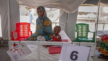 Alultáplált, Dárfúrból menekült szudáni gyereket kezelnek a csádi Metche-táborban található MSF-klinikán 
