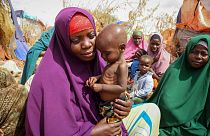 أم وطفلها الذي يعاني من سوء التغذية في مخيم مؤقت للنازحين مقديشو، الصومال