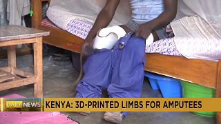 Kenyan company becomes country’s first to 3D print prosthetic limbs