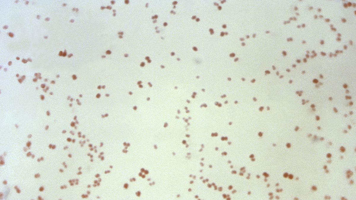Esta imagen microscópica de 1971 muestra la bacteria Neisseria gonorrhoeae, causante de la enfermedad de transmisión sexual gonorrea.
