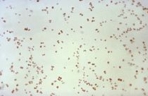 This 1971 microscope image shows Neisseria gonorrhoeae bacteria, which causes the sexually transmitted disease gonorrhoea.