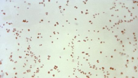 This 1971 microscope image shows Neisseria gonorrhoeae bacteria, which causes the sexually transmitted disease gonorrhoea.